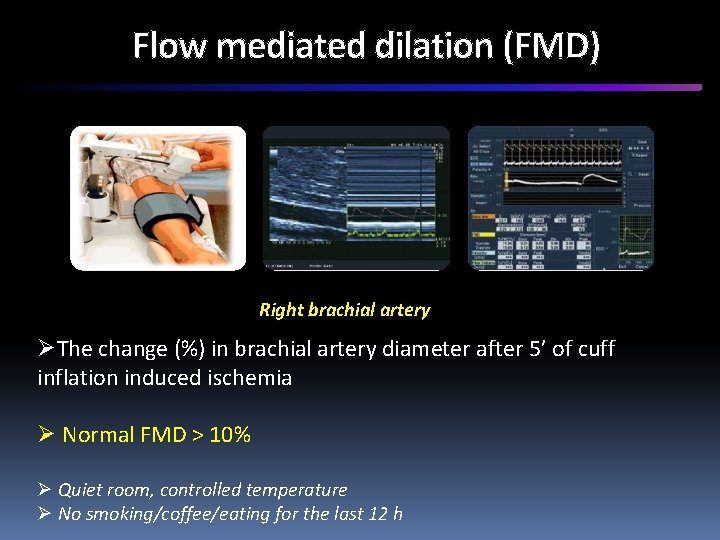 Flow mediated dilation (FMD) Right brachial artery ØThe change (%) in brachial artery diameter