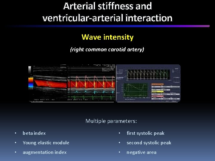 Arterial stiffness and ventricular-arterial interaction Wave intensity (right common carotid artery) Multiple parameters: •