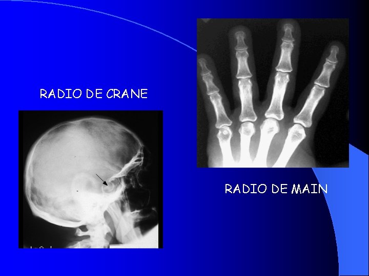 RADIO DE CRANE RADIO DE MAIN 