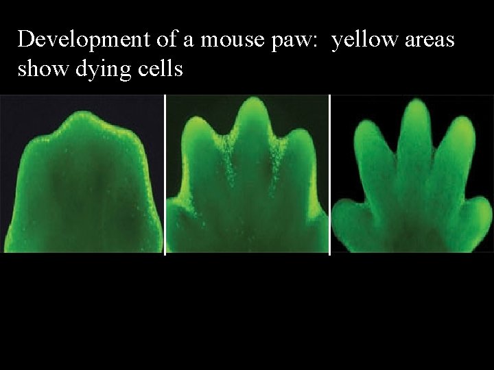 Development of a mouse paw: yellow areas show dying cells CB 21. 19 