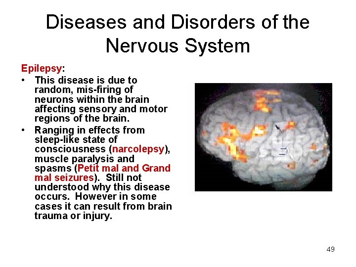 Diseases and Disorders of the Nervous System Epilepsy: • This disease is due to