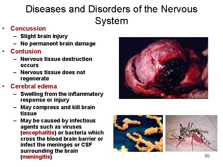 Diseases and Disorders of the Nervous System • Concussion – Slight brain injury –