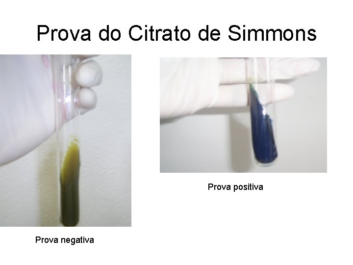 Prova do Citrato de Simmons Prova positiva Prova negativa 