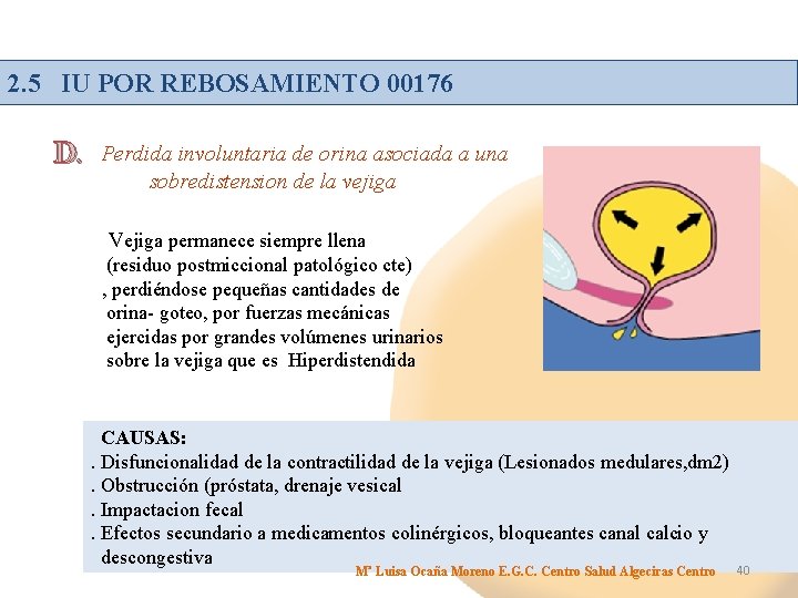 2. 5 IU POR REBOSAMIENTO 00176 D. Perdida involuntaria de orina asociada a una