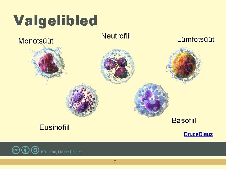 Valgelibled Monotsüüt Neutrofiil Lümfotsüüt Basofiil Eusinofiil Bruce. Blaus Külli Kori, Meelis Brikker 7 