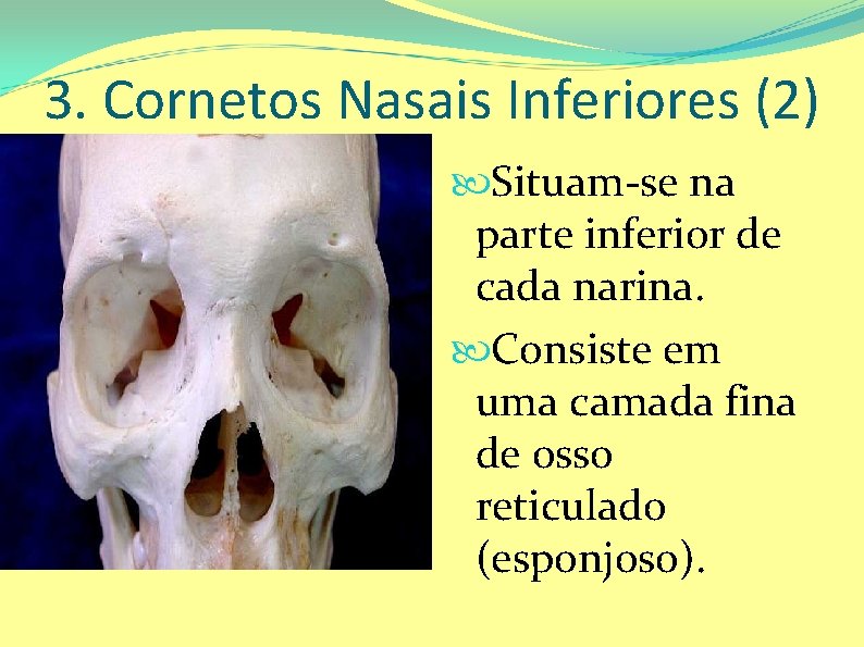 3. Cornetos Nasais Inferiores (2) Situam-se na parte inferior de cada narina. Consiste em