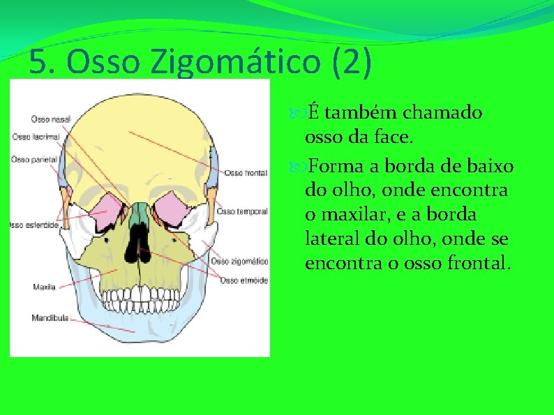 5. Osso Zigomático (2) É também chamado osso da face. Forma a borda de