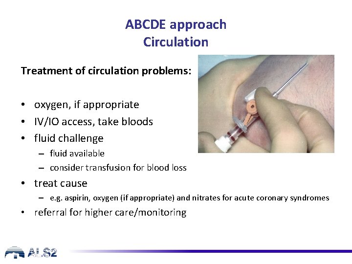 ABCDE approach Circulation Treatment of circulation problems: • oxygen, if appropriate • IV/IO access,