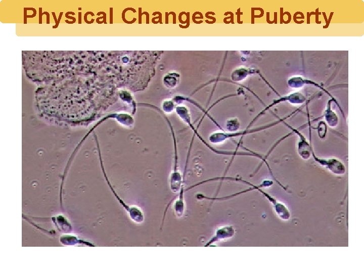 Physical Changes at Puberty 