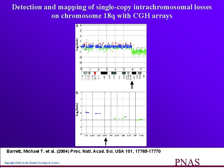 Detection and mapping of single-copy intrachromosomal losses on chromosome 18 q with CGH arrays
