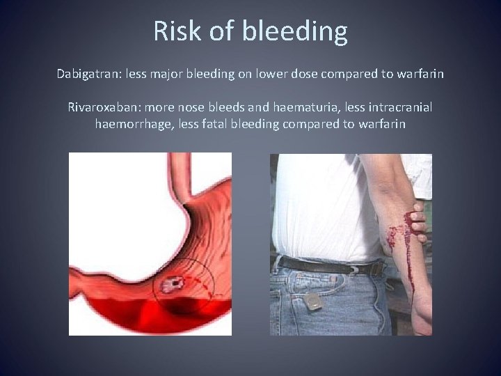 Risk of bleeding Dabigatran: less major bleeding on lower dose compared to warfarin Rivaroxaban: