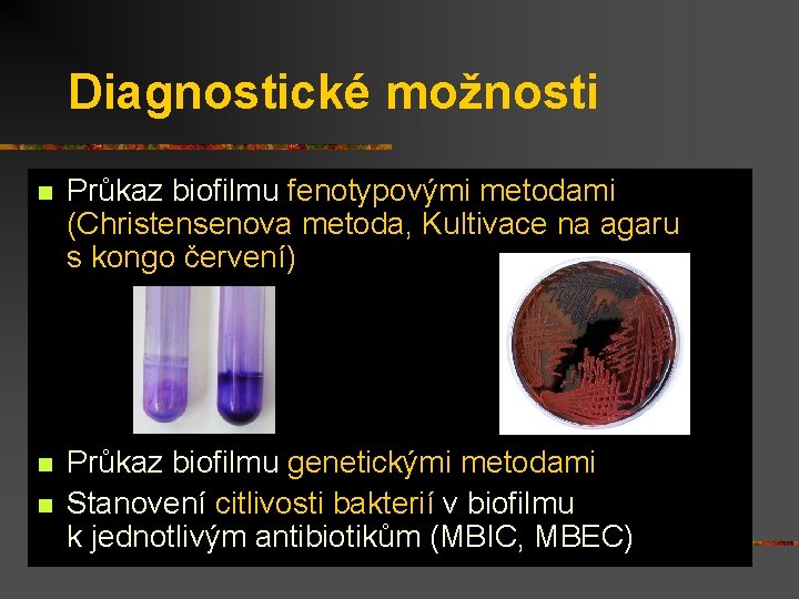 Diagnostické možnosti n Průkaz biofilmu fenotypovými metodami (Christensenova metoda, Kultivace na agaru s. kongo