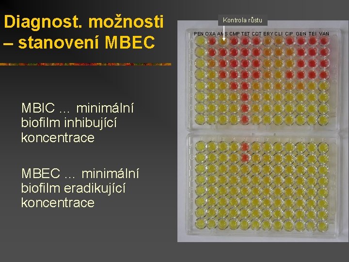 Diagnost. možnosti – stanovení MBEC MBIC … minimální biofilm inhibující koncentrace MBEC … minimální