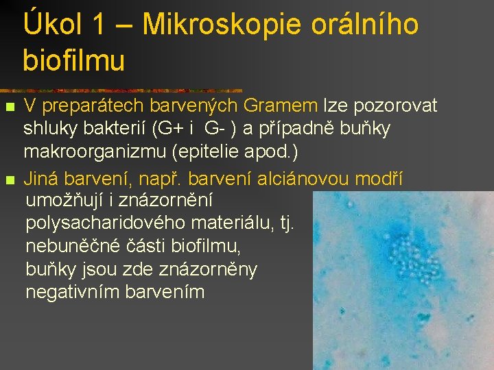 Úkol 1 – Mikroskopie orálního biofilmu n n V preparátech barvených Gramem lze pozorovat