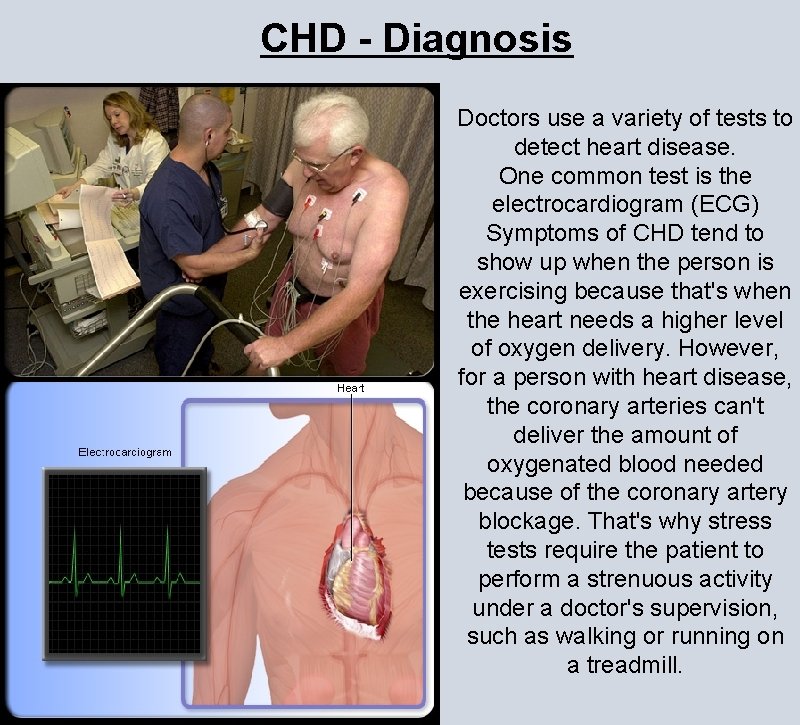 CHD - Diagnosis Doctors use a variety of tests to detect heart disease. One CHD - Diagnosis Doctors use a variety of tests to detect heart disease. One