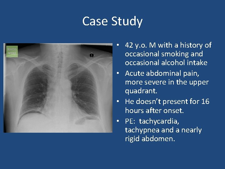 Case Study • 42 y. o. M with a history of occasional smoking and