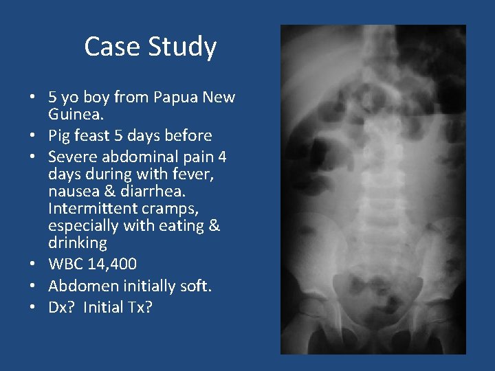 Case Study • 5 yo boy from Papua New Guinea. • Pig feast 5