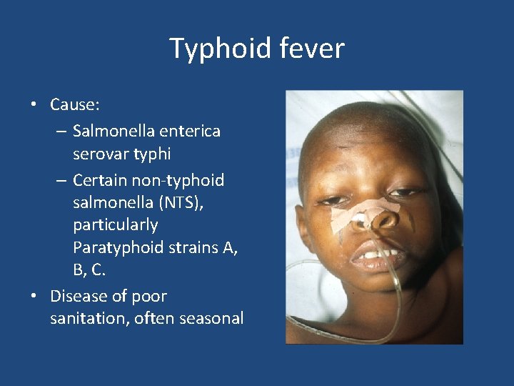 Typhoid fever • Cause: – Salmonella enterica serovar typhi – Certain non-typhoid salmonella (NTS),