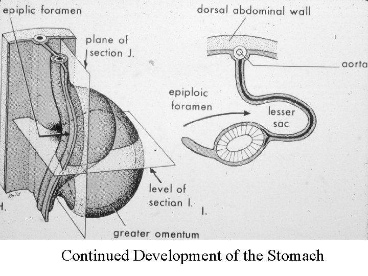 Continued Development of the Stomach 