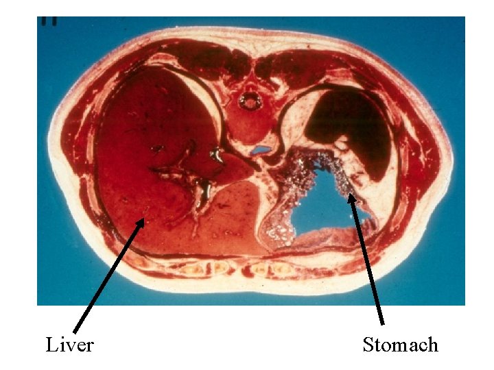 Liver Stomach 