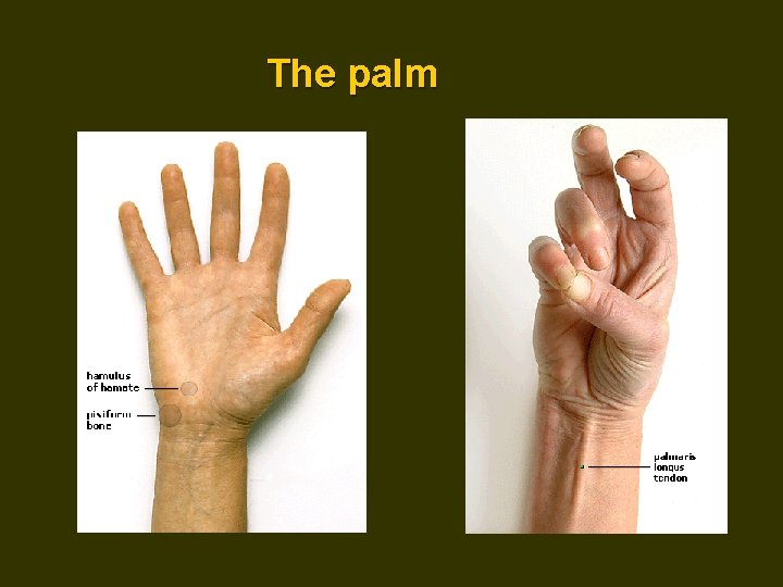 The palm 