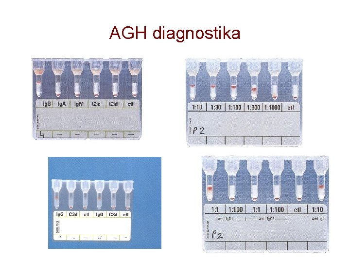 AGH diagnostika 