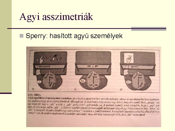 Agyi asszimetriák n Sperry: hasított agyú személyek 