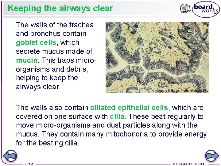 Keeping the airways clear The walls of the trachea and bronchus contain goblet cells,