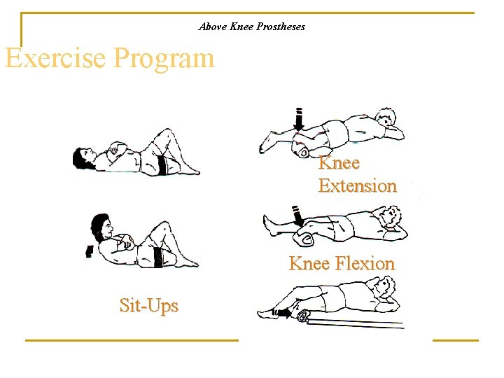 Above Knee Prostheses Exercise Program Knee Extension Knee Flexion Sit-Ups 