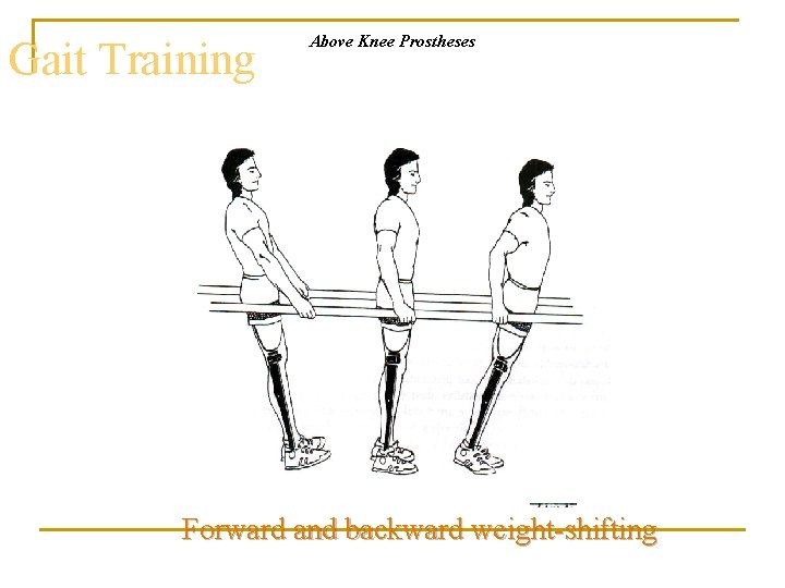 Gait Training Above Knee Prostheses Forward and backward weight-shifting 