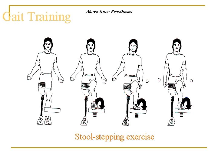Gait Training Above Knee Prostheses Stool-stepping exercise 