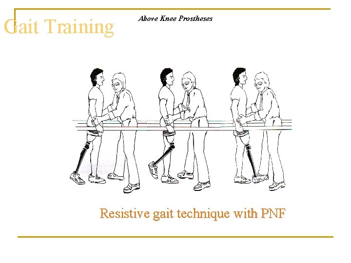 Gait Training Above Knee Prostheses Resistive gait technique with PNF 