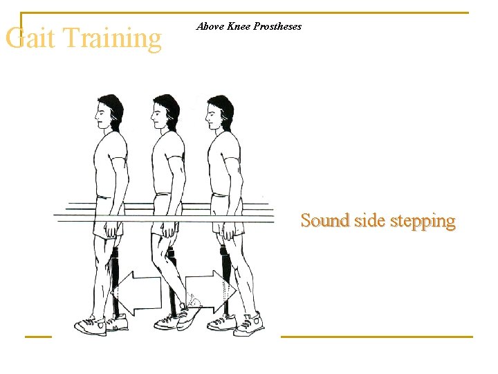 Gait Training Above Knee Prostheses Sound side stepping 