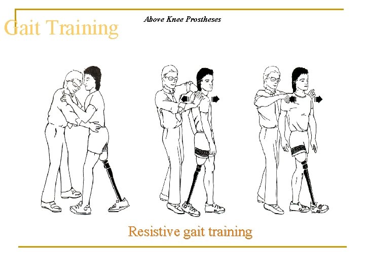 Gait Training Above Knee Prostheses Resistive gait training 