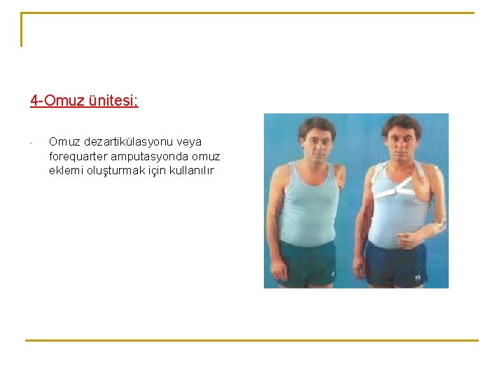 4 -Omuz ünitesi; - Omuz dezartikülasyonu veya forequarter amputasyonda omuz eklemi oluşturmak için kullanılır