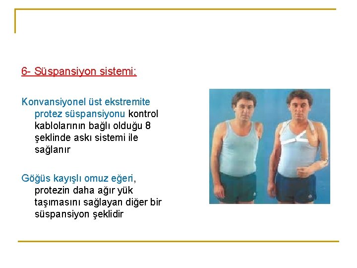 6 - Süspansiyon sistemi; Konvansiyonel üst ekstremite protez süspansiyonu kontrol kablolarının bağlı olduğu 8