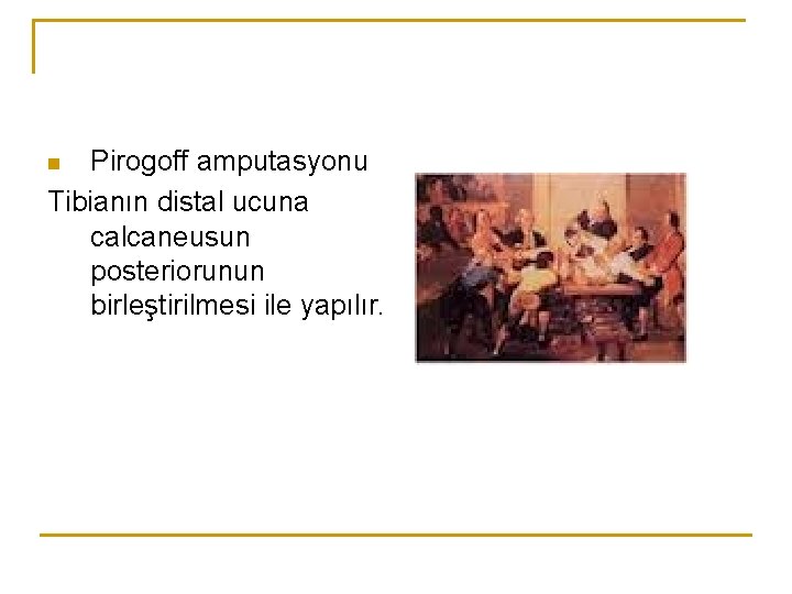 Pirogoff amputasyonu Tibianın distal ucuna calcaneusun posteriorunun birleştirilmesi ile yapılır. n 