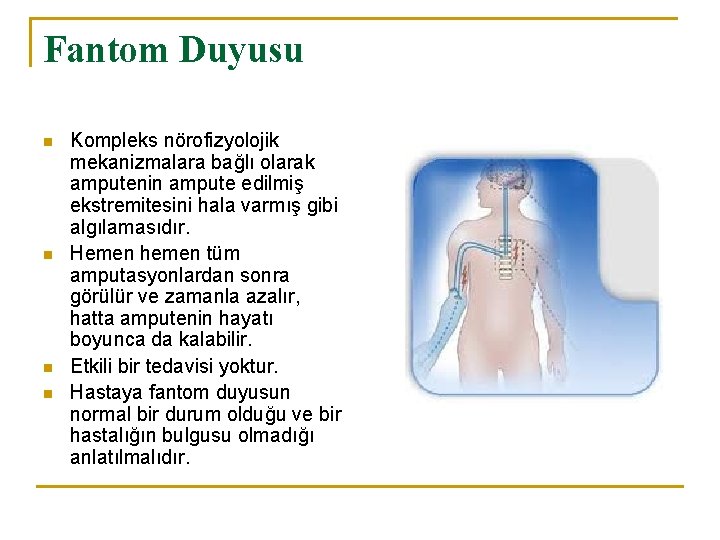 Fantom Duyusu n n Kompleks nörofizyolojik mekanizmalara bağlı olarak amputenin ampute edilmiş ekstremitesini hala