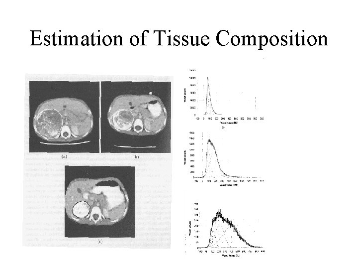 Estimation of Tissue Composition Estimation of Tissue Composition