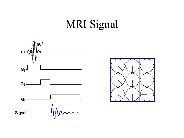 MRI Signal MRI Signal