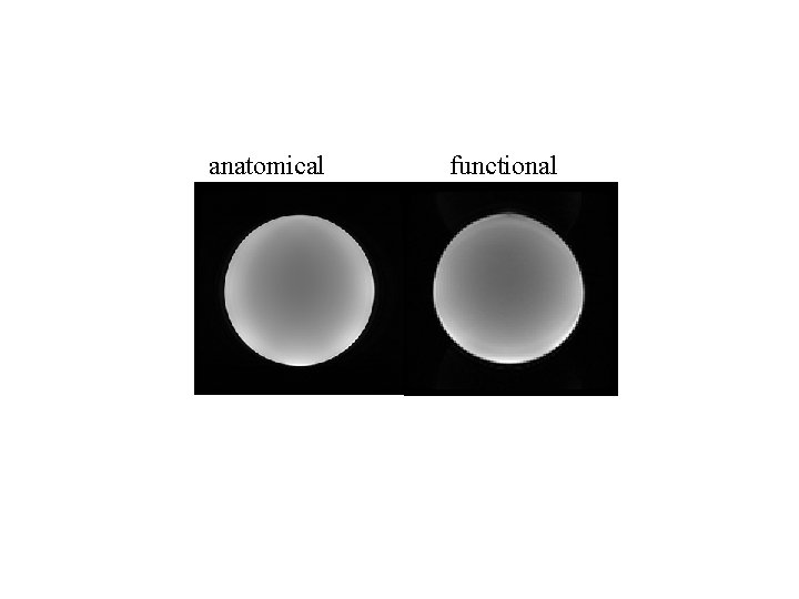 anatomical functional anatomical functional