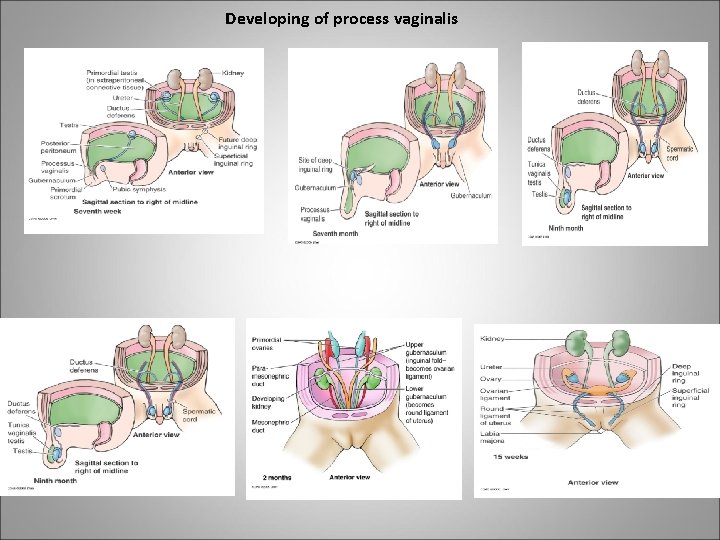 Developing of process vaginalis 