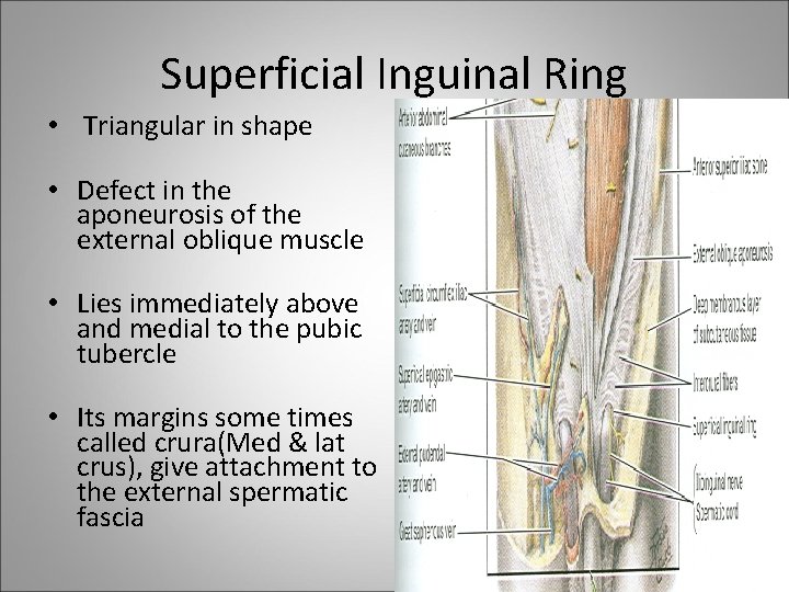 Superficial Inguinal Ring • Triangular in shape • Defect in the aponeurosis of the