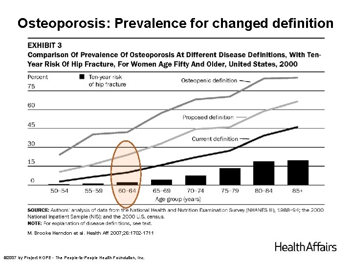 Osteoporosis: Prevalence for changed definition M. Brooke Herndon et al. Health Aff 2007; 26: