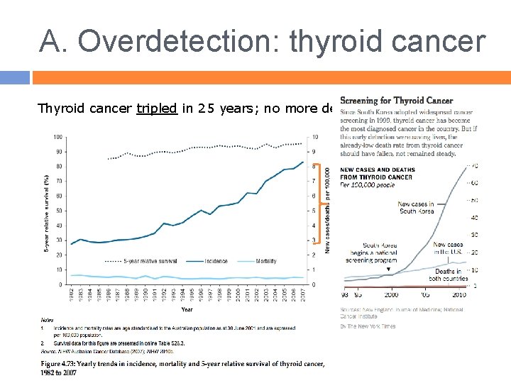 A. Overdetection: thyroid cancer Thyroid cancer tripled in 25 years; no more deaths 