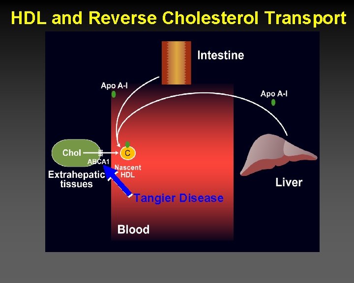 HDL and Reverse Cholesterol Transport Tangier Disease 