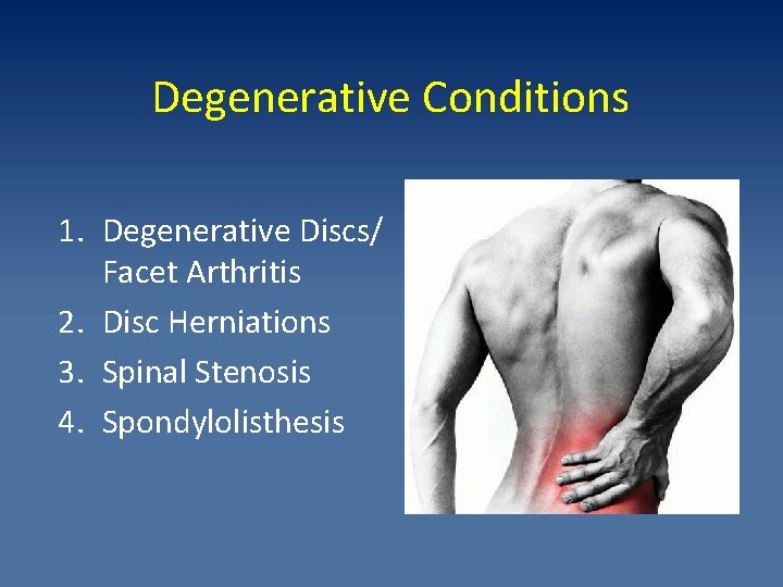 Degenerative Conditions 1. Degenerative Discs/ Facet Arthritis 2. Disc Herniations 3. Spinal Stenosis 4.