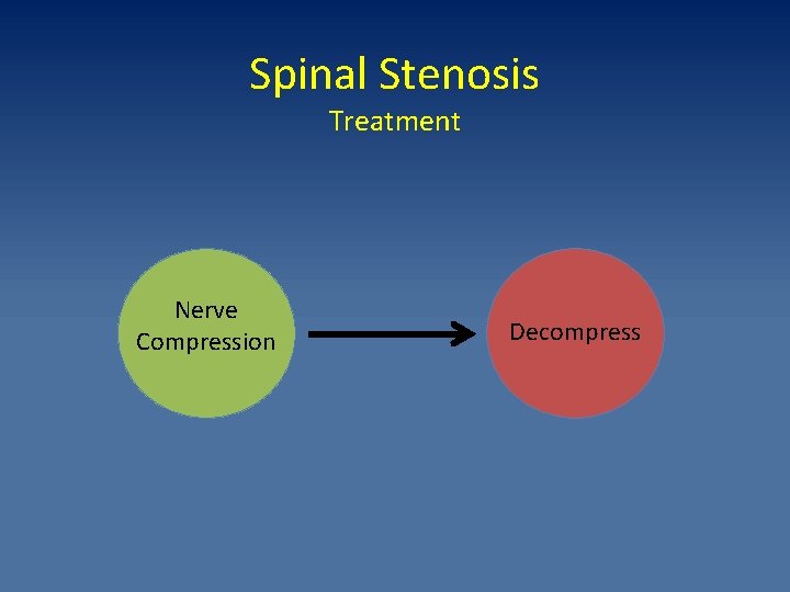 Spinal Stenosis Treatment Nerve Compression Decompress 