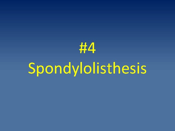 #4 Spondylolisthesis 