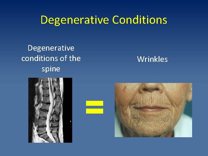 Degenerative Conditions Degenerative conditions of the spine Wrinkles 